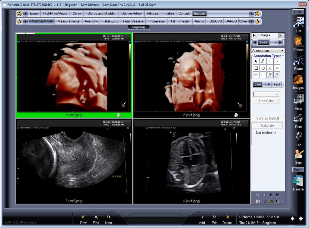 Imaging – Vision Chips, Inc